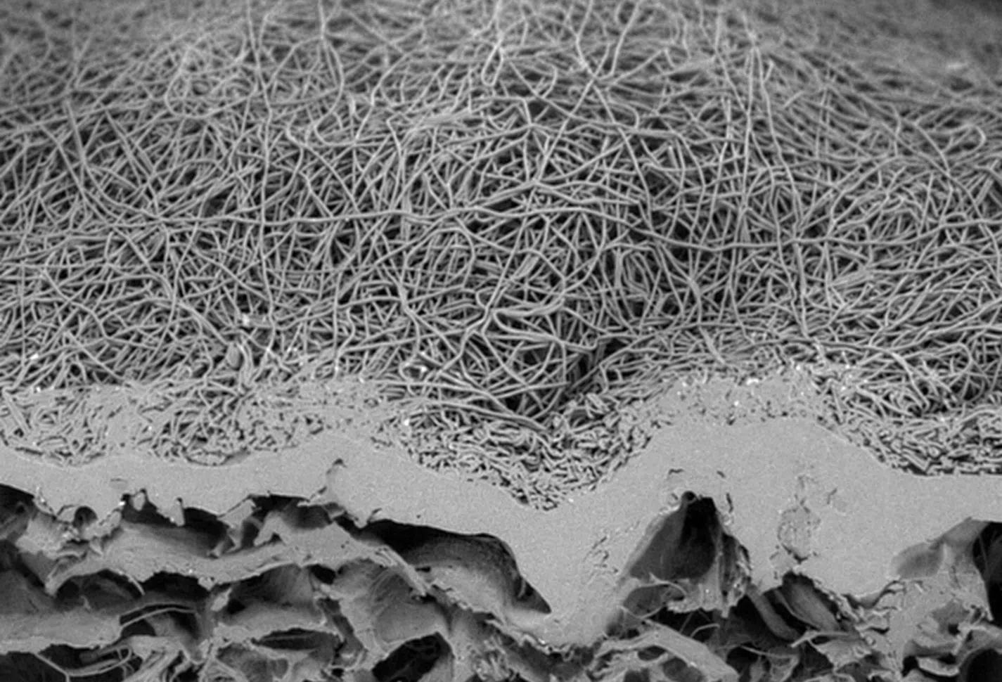 Close-up of electrospun fibres deposited on a medical textile.