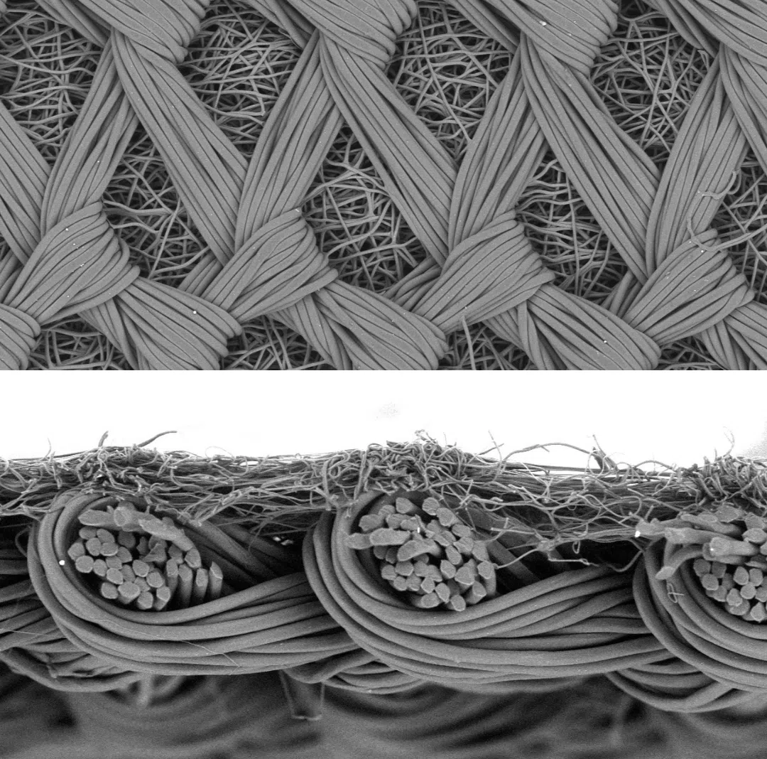 Electrospun material layer positioned with a medical textile and natural membrane substrate.